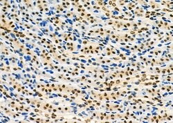 Invitrogen PCBP1 Polyclonal Antibody 100 &mu;L | Buy Online | Invitrogen&trade; | Fisher Scientific