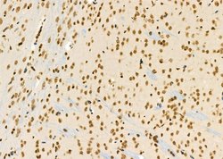Invitrogen PCBP1 Polyclonal Antibody 100 &mu;L | Buy Online | Invitrogen&trade; | Fisher Scientific