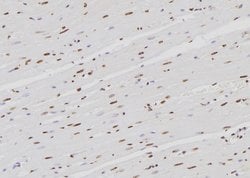 Invitrogen hnRNP K Polyclonal Antibody 100 &mu;L | Buy Online | Invitrogen&trade; | Fisher Scientific