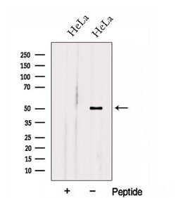 Invitrogen HOXA10 Polyclonal Antibody 100 &mu;L; Unconjugated:Antibodies,
