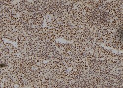 Invitrogen HOXA11 Polyclonal Antibody 100 &mu;L; Unconjugated:Antibodies,