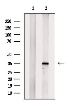 Invitrogen HOXA4 Polyclonal Antibody 100 &mu;L; Unconjugated:Antibodies,