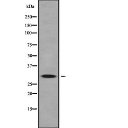 Invitrogen HOXC9 Polyclonal Antibody 100 &mu;L | Buy Online | Invitrogen&trade; | Fisher Scientific