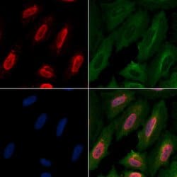 Invitrogen HP1 gamma Polyclonal Antibody 100 &mu;L; Unconjugated:Antibodies,