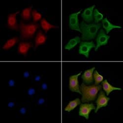 Invitrogen HP1 gamma Polyclonal Antibody 100 &mu;L; Unconjugated:Antibodies,