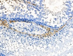 Invitrogen HSD11B1 Polyclonal Antibody 100 &mu;L; Unconjugated:Antibodies,