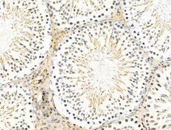 Invitrogen HtrA1 Polyclonal Antibody 100 &mu;L | Buy Online | Invitrogen&trade; | Fisher Scientific