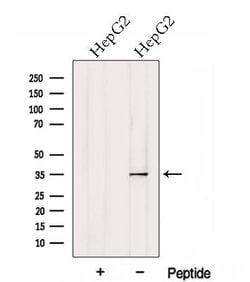 Invitrogen HtrA1 Polyclonal Antibody 100 &mu;L | Buy Online | Invitrogen&trade; | Fisher Scientific