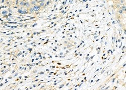 Invitrogen ICOS (CD278) Polyclonal Antibody 100 &mu;L; Unconjugated:Antibodies,