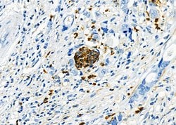 Invitrogen ICOS (CD278) Polyclonal Antibody 100 &mu;L; Unconjugated:Antibodies,