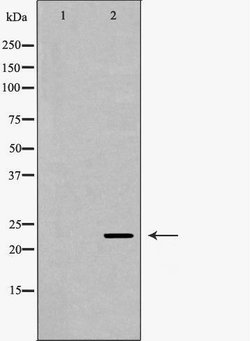 Invitrogen ICOS (CD278) Polyclonal Antibody 100 &mu;L; Unconjugated:Antibodies,