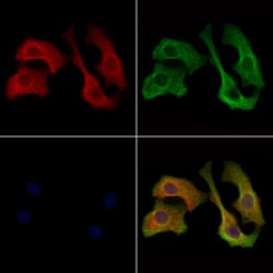 Invitrogen Human IgA Polyclonal Antibody 100 &mu;L; Unconjugated:Antibodies,