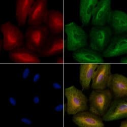 Invitrogen Ihh Polyclonal Antibody 100 &mu;L; Unconjugated:Antibodies,