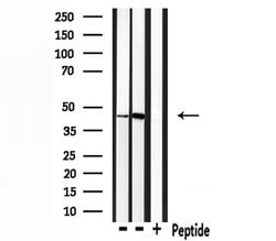 Invitrogen Ihh Polyclonal Antibody 100 &mu;L; Unconjugated:Antibodies,