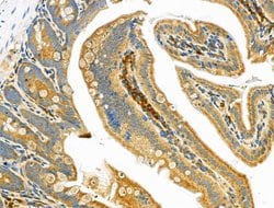 Invitrogen IL-12 p40 Polyclonal Antibody 100 &mu;L; Unconjugated:Antibodies,