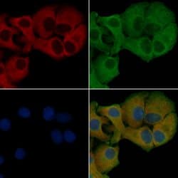 Invitrogen IL-21 Polyclonal Antibody 100 &mu;L; Unconjugated:Antibodies,