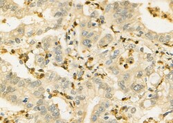 Invitrogen IL-21 Polyclonal Antibody 100 &mu;L; Unconjugated:Antibodies,