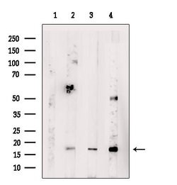 Invitrogen IL-21 Polyclonal Antibody 100 &mu;L; Unconjugated:Antibodies,