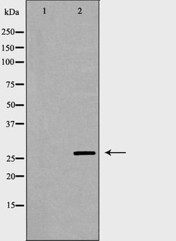 Invitrogen IL-27 p28 Polyclonal Antibody 100 μL; Unconjugated:Antibodies,