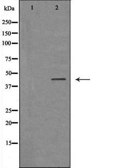 Invitrogen IL2RG Polyclonal Antibody 100 &mu;L; Unconjugated:Antibodies,