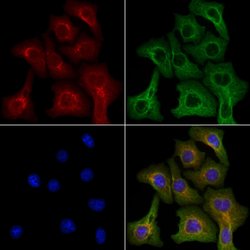 Invitrogen IL-3 Polyclonal Antibody 100 &mu;L; Unconjugated:Antibodies,