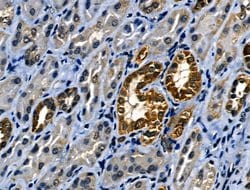 Invitrogen IL-4 Polyclonal Antibody 100 &mu;L; Unconjugated:Antibodies,