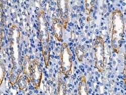 Invitrogen IL-4 Polyclonal Antibody 100 &mu;L; Unconjugated:Antibodies,
