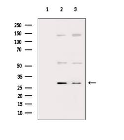 Invitrogen IL-4 Polyclonal Antibody 100 &mu;L; Unconjugated:Antibodies,