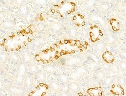 IL4I1 Polyclonal Antibody:Antibodies, Polyclonal