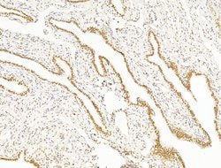Invitrogen ILF1 Polyclonal Antibody 100 &mu;L; Unconjugated:Antibodies,