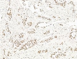 Invitrogen ILF1 Polyclonal Antibody 100 &mu;L; Unconjugated:Antibodies,
