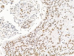 Invitrogen ILF1 Polyclonal Antibody 100 &mu;L; Unconjugated:Antibodies,