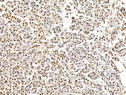 Invitrogen ILF1 Polyclonal Antibody 100 &mu;L; Unconjugated:Antibodies,