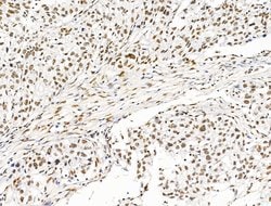 Invitrogen ILF1 Polyclonal Antibody 100 &mu;L; Unconjugated:Antibodies,