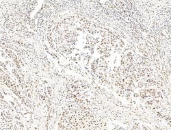 Invitrogen ILF1 Polyclonal Antibody 100 &mu;L; Unconjugated:Antibodies,