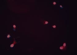 Invitrogen&trade;&nbsp;ILK Polyclonal Antibody