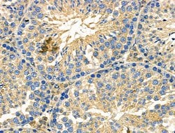 Invitrogen ILK Polyclonal Antibody 100 &mu;L | Buy Online | Invitrogen&trade; | Fisher Scientific