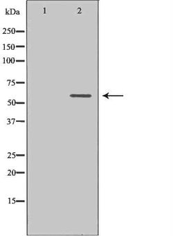Invitrogen ILK Polyclonal Antibody 100 &mu;L | Buy Online | Invitrogen&trade; | Fisher Scientific