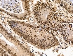 Invitrogen Importin 7 Polyclonal Antibody 100 &mu;L; Unconjugated:Antibodies,