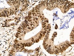 Invitrogen Importin 7 Polyclonal Antibody 100 &mu;L; Unconjugated:Antibodies,