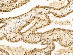 Invitrogen Importin 7 Polyclonal Antibody 100 &mu;L; Unconjugated:Antibodies,