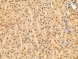 Invitrogen Importin 7 Polyclonal Antibody 100 &mu;L; Unconjugated:Antibodies,