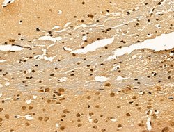 Invitrogen Importin 7 Polyclonal Antibody 100 &mu;L; Unconjugated:Antibodies,