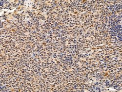 Invitrogen Importin 7 Polyclonal Antibody 100 &mu;L; Unconjugated:Antibodies,