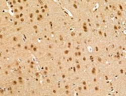 Invitrogen Importin 7 Polyclonal Antibody 100 &mu;L; Unconjugated:Antibodies,