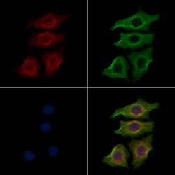 Invitrogen INSR Polyclonal Antibody 100 &mu;L; Unconjugated:Antibodies,
