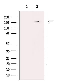 Invitrogen INSR Polyclonal Antibody 100 &mu;L; Unconjugated:Antibodies,