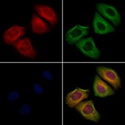 Invitrogen IFN alpha Polyclonal Antibody 100 &mu;L; Unconjugated:Antibodies,