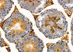 Invitrogen IFN alpha Polyclonal Antibody 100 &mu;L; Unconjugated:Antibodies,