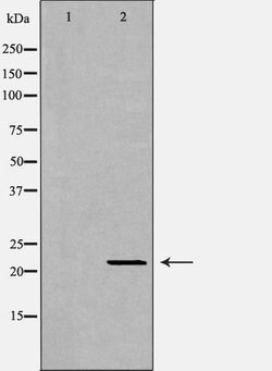 Invitrogen IFN alpha Polyclonal Antibody 100 &mu;L; Unconjugated:Antibodies,